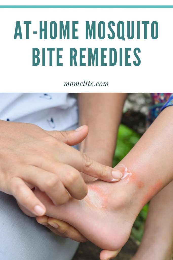 AtHome Mosquito Bite Remedies